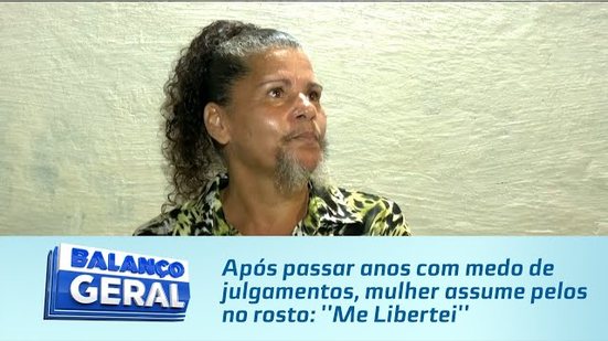 Após passar anos com medo de julgamentos, mulher assume pelos no rosto: ''Me Libertei''