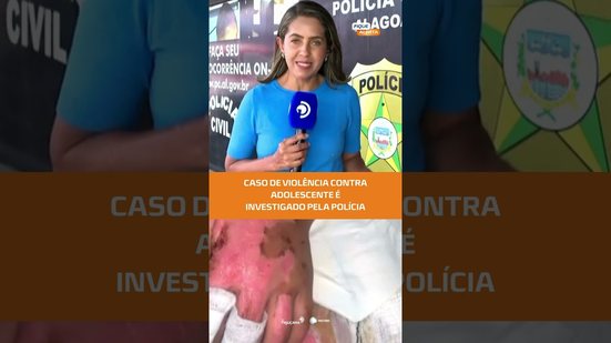 Adolescente de 16 anos tem corpo queimado e recebe ameaças do ex-namorado #FiqueAlerta