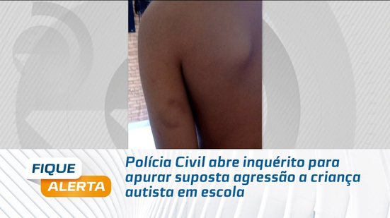Polícia Civil abre inquérito para apurar suposta agressão a criança autista em escola