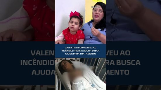Menina que sobreviveu ao incêndio precisa de tratamento especializado #CidadeAL