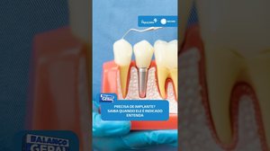 🦷Implante dentário: entenda como funciona e para quem é indicado #BalançoGeralAL
