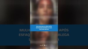 🚨Mulher afirma ter se defendido após agressões do marido #BalançoGeralAL