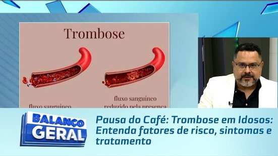 Pausa do Café: Trombose em Idosos: Entenda fatores de risco, sintomas e tratamento