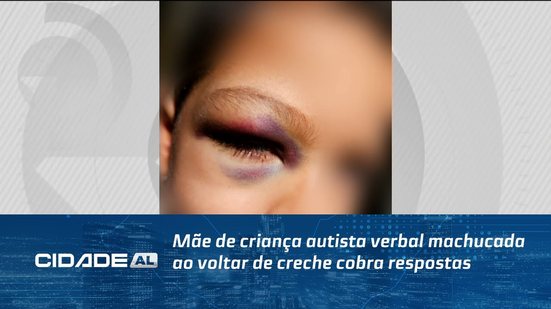 Mãe de criança autista verbal machucada ao voltar de creche cobra respostas