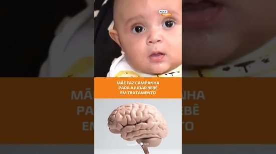 Família busca apoio para tratamento de bebê com deformidade craniana #FiqueAlerta