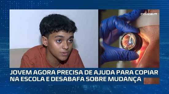 Com ceratocone, Arilan, de 13 anos, precisa passar por uma cirurgia para não perder a visão