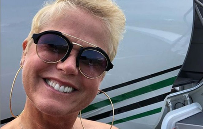 Por que cirurgia de Xuxa durou 20 minutos? Entenda a artroscopia de joelho