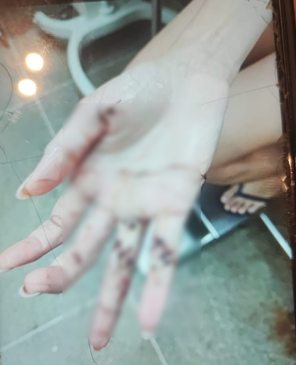 Jovem foi vítima de uma tentativa de feminicídio a facadas 
