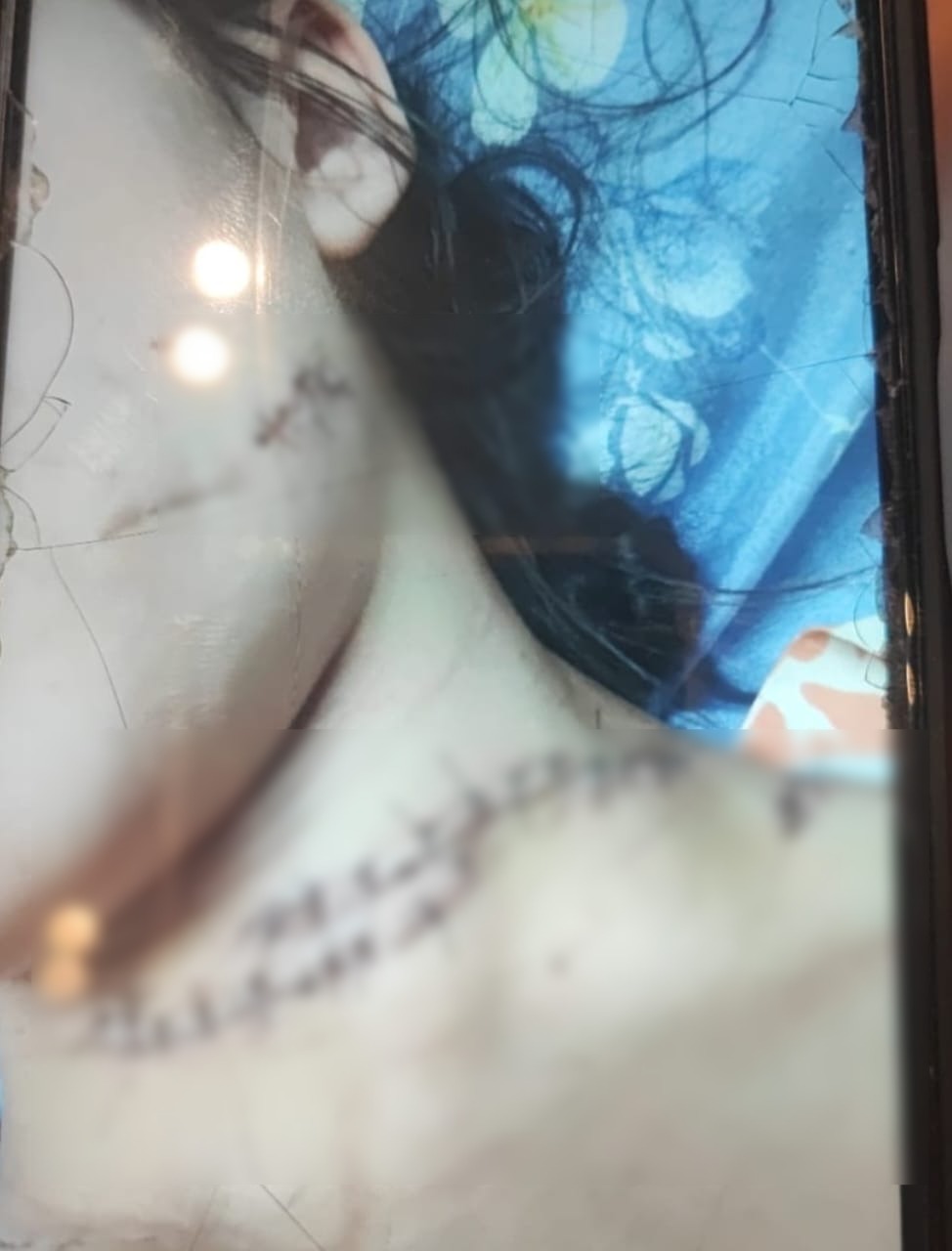 Jovem foi vítima de uma tentativa de feminicídio a facadas 