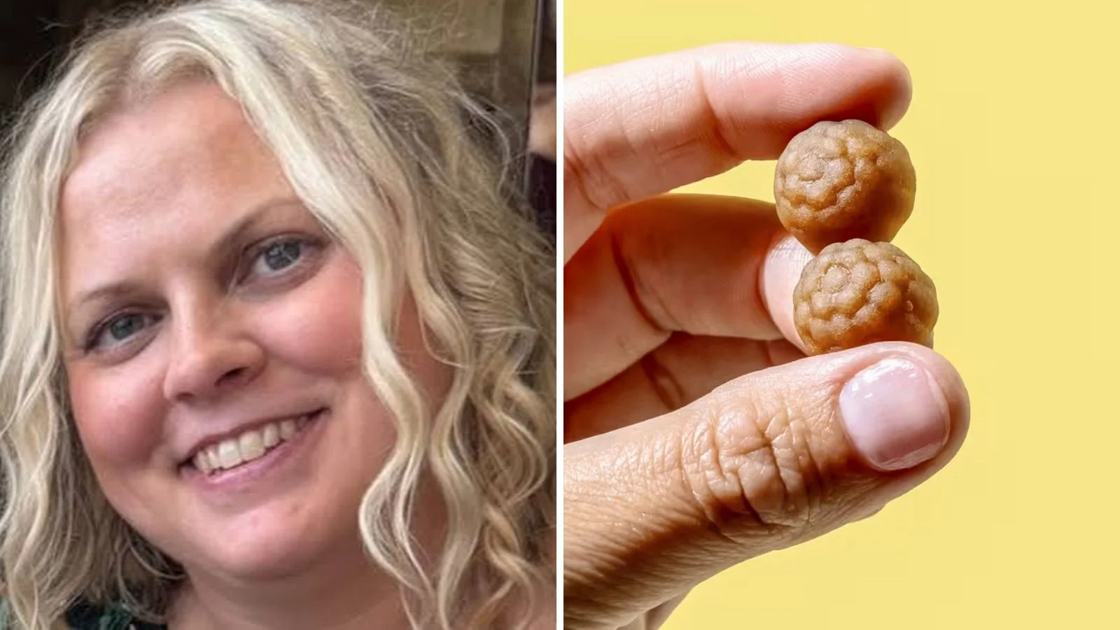 Mulher tem falência hepática, três paradas cardíacas e danos cerebrais após usar suplemento viral do TikTok