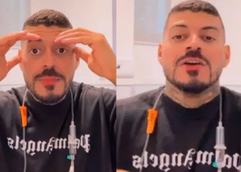Homem só percebe que seu cachorro comeu o dedo do pé após acordar