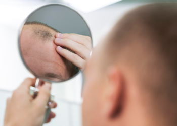 Ingrediente que muitos brasileiros tem na cozinha pode fazer o cabelo crescer novamente, revelam pesquisadores chineses e australianos