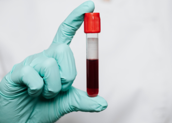 Saiba quanto tempo você ainda tem de vida com esse novo exame de sangue