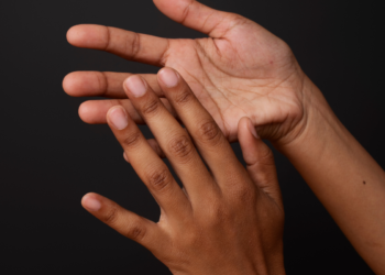 Um pequeno sinal nas suas unhas pode indicar que seu corpo está lutando contra o câncer