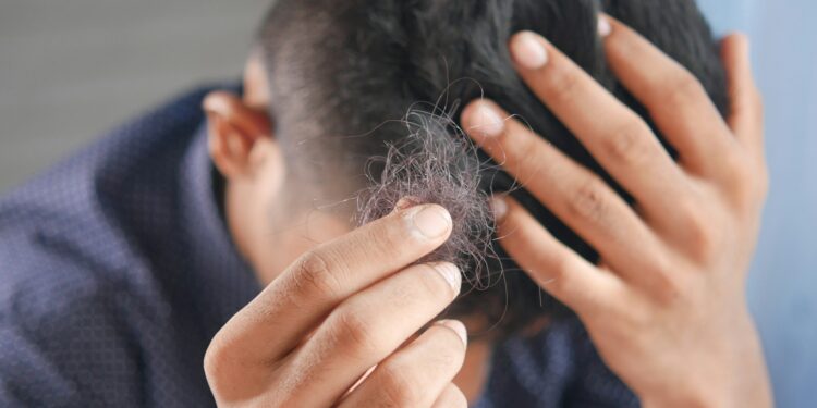 Acordar com a cama cheia de cabelo pode ser um alerta sério do seu corpo