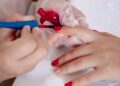 Especialistas explicam evitar esmalte saia