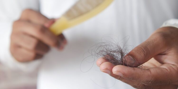 Tratamento queda cabelo promete disputar