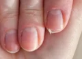 O que a quebra frequente das unhas significa para a espiritualidade, segundo uma antiga crença