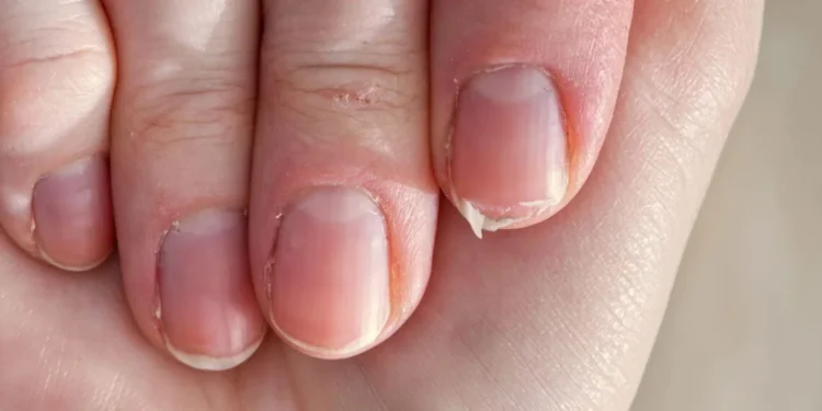 O que a quebra frequente das unhas significa para a espiritualidade, segundo uma antiga crença