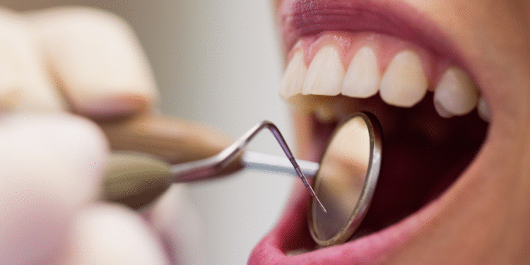 Medicamento japonês é capaz de curar dentes podres e melhorar a saúde bucal