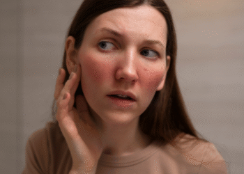 Mudança inesperada na pele está ligada a doenças cardíacas