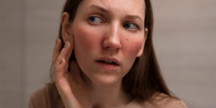 Mudança inesperada na pele está ligada a doenças cardíacas