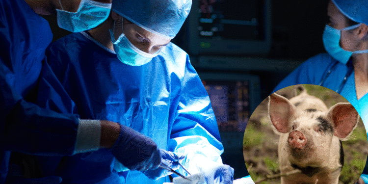 Transplante bizarro ou milagre? Rim de porco pode virar órgão para humanos nos EUA