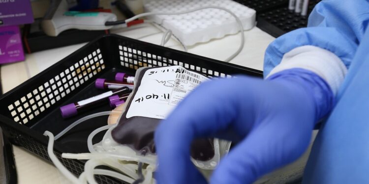 O pior tipo de sangue: um estudo científico revelou qual grupo tem mais chances de sofrer infartos