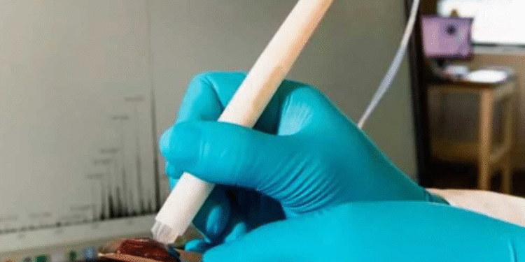 Caneta que antecipa o câncer chega ao Brasil e promete salvar a vida de milhões