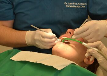 Nem a cada 4 meses nem a cada 1 ano: quando é necessário fazer uma limpeza bucal, segundo dentistas