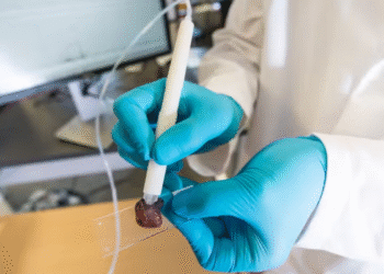 Caneta criada por brasileira detecta o câncer em apenas 10 segundos