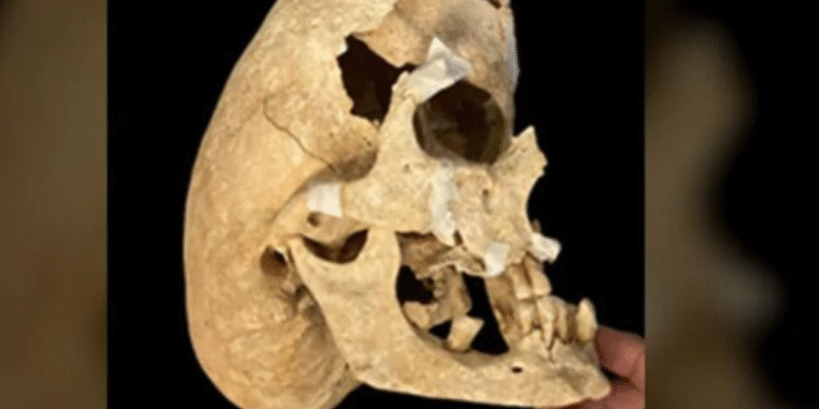 Esqueleto de guerreiro medieval surpreende cientistas e revela mutação extremamente rara