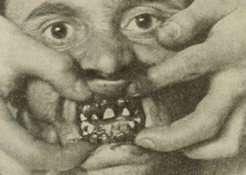 Pão mofado na lancheira de menino revela “doença dos marinheiros” do século 18