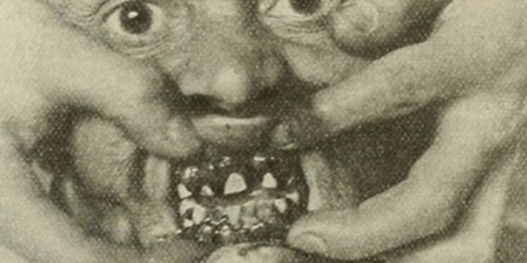 Pão mofado na lancheira de menino revela “doença dos marinheiros” do século 18