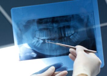 Cientistas descobrem tesouro valioso que fica dentro dos dentes do siso