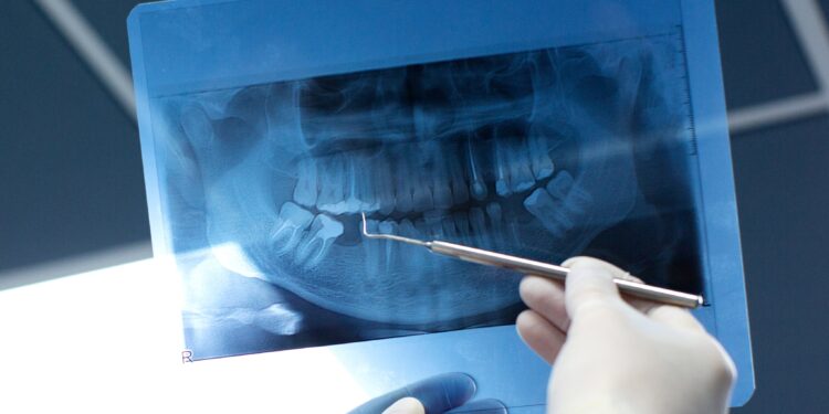 Cientistas descobrem tesouro valioso que fica dentro dos dentes do siso