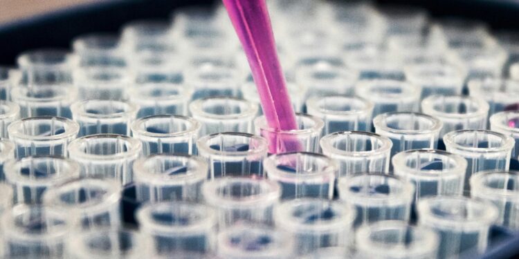 Medicamento inovador surge como esperança para pacientes que já tiveram AVC