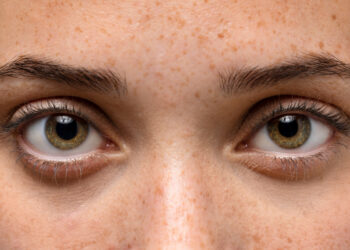 Você vê pontos ou manchas se movendo na visão? Isso pode ter explicação médica