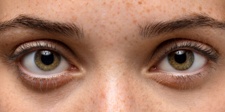 Você vê pontos ou manchas se movendo na visão? Isso pode ter explicação médica