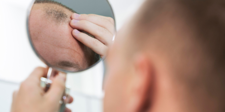 Adeus, calvície: tratamento criado na Ásia promete crescimento capilar acelerado até em carecas