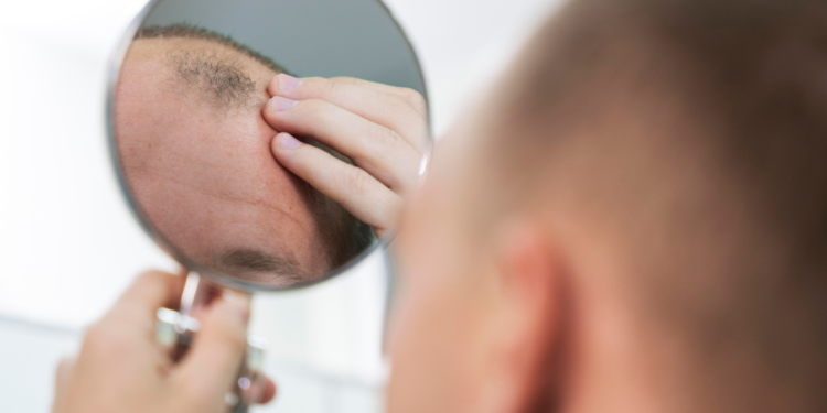 Ingrediente que muitos brasileiros tem na cozinha pode fazer o cabelo crescer novamente, revelam pesquisadores chineses e australianos