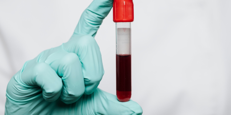 Saiba quanto tempo você ainda tem de vida com esse novo exame de sangue