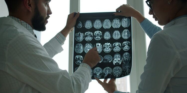 Estudo revela: Alzheimer é menos comum em quem trabalha nessas áreas