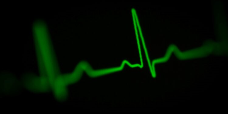 O cérebro não “desliga” de imediato: médicos explicam o que você sente ao morrer