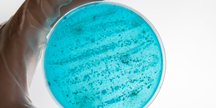 Alerta no Brasil: uma das piores superbactérias do mundo já foi identificada no país