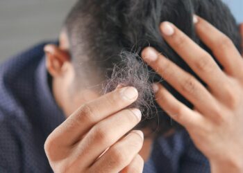 Acordar com a cama cheia de cabelo pode ser um alerta sério do seu corpo